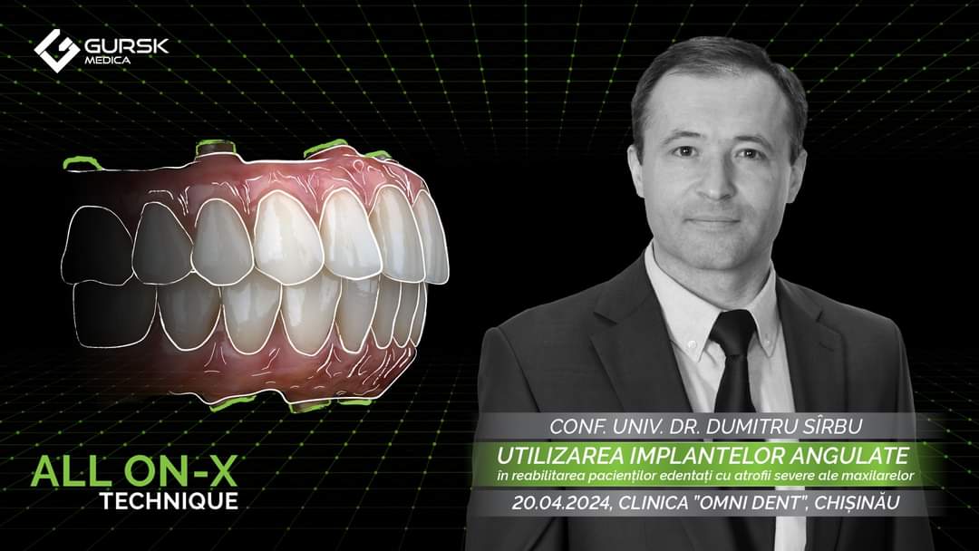 Оро-челюстно-лицевой хирург, доктор медицинских наук, доцент Думитру Сырбу выступил экспертом для стоматологов, желающих исследовать новые горизонты имплантологии.