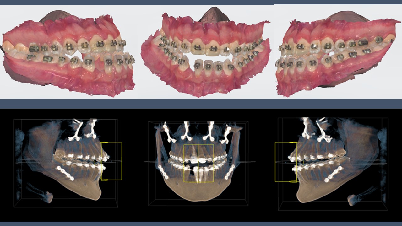 Anomaliile dentare pot fi corectate de medicii specialiști de la Clinica stomatologică ”Omni Dent”